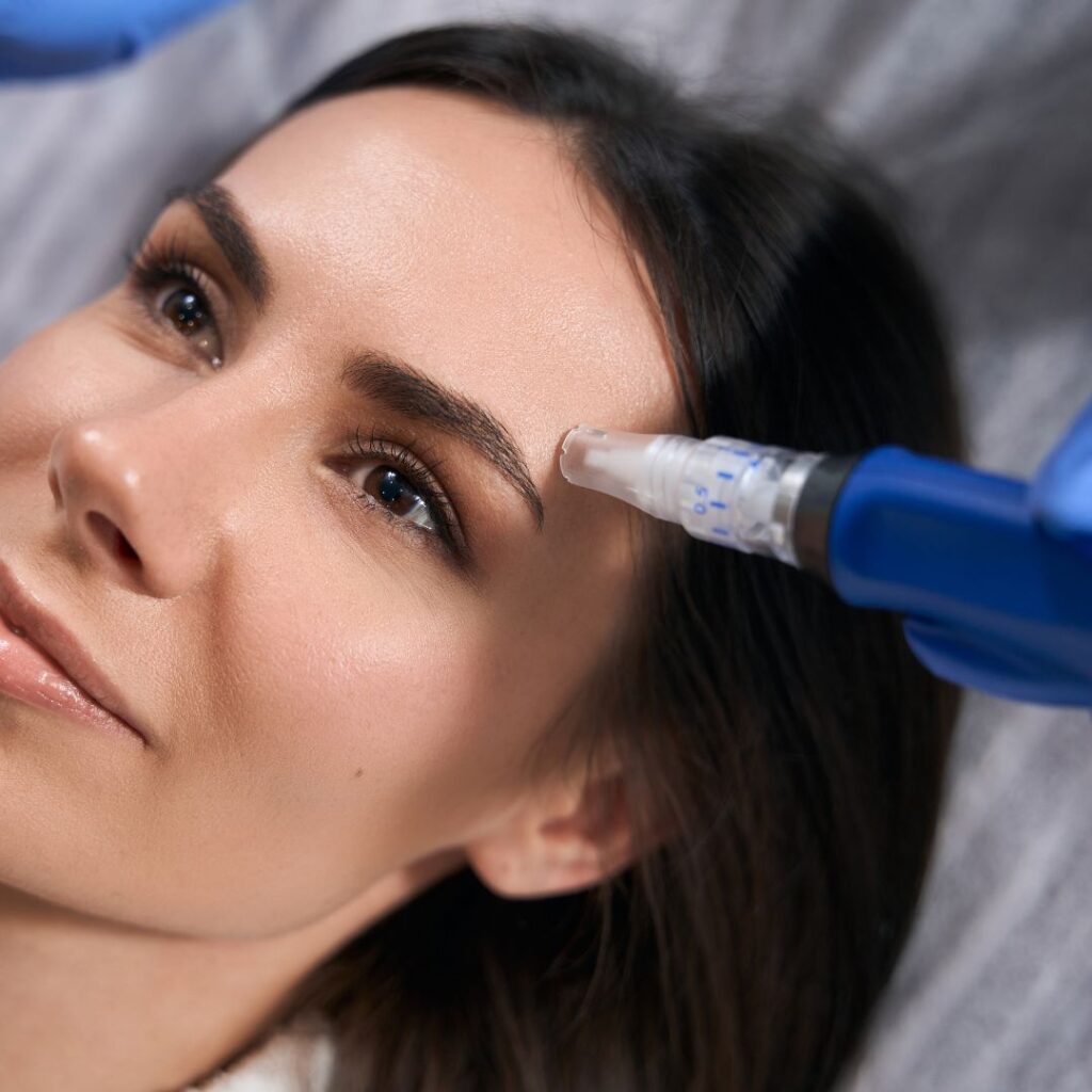 Microneedling