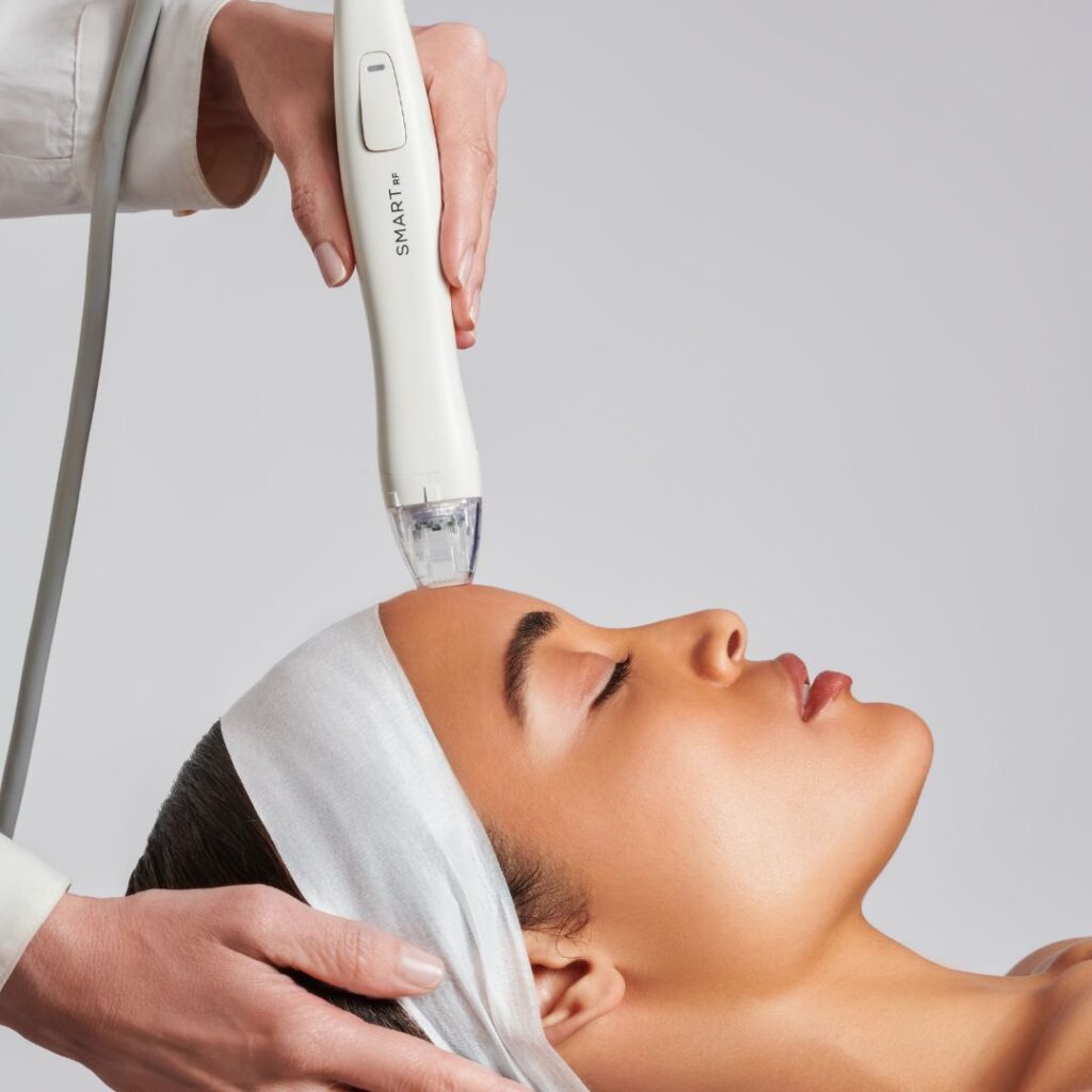 Virtue RF Microneedling with Radiofrequency